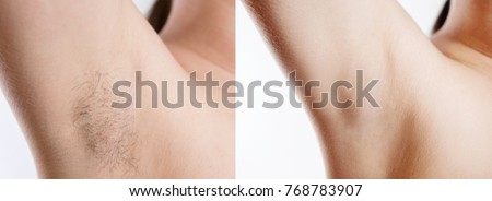 Woman with armpit hair, female hairy armpit, before and after shaving