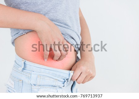 Young woman scratch the itch on him belly, Healthcare concept. Royalty-Free Stock Photo #769713937