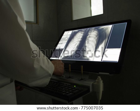 Radiologist. Examining x-ray picture of lungs