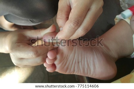 Women are removing a splinter of wood with needles in the baby's foot. Royalty-Free Stock Photo #775114606