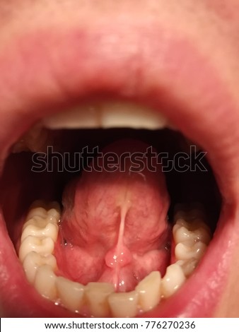 Tongue seen from below Royalty-Free Stock Photo #776270236