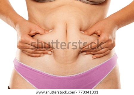 Woman pinching a fat on her belly on white background