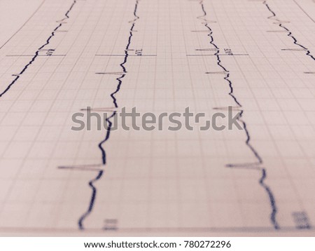 Electrocardiogram record for paper.