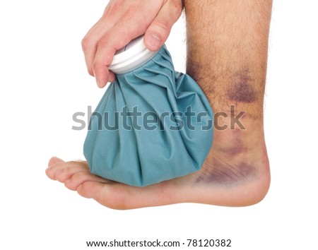 young male icing a sprained ankle with ice pack (isolated on white background) Royalty-Free Stock Photo #78120382