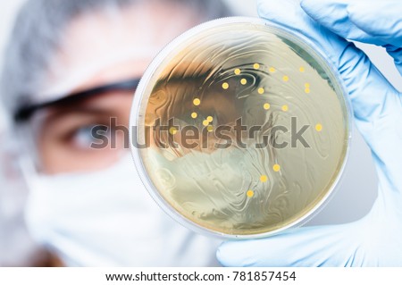 Lactobacillus bacteria colonies. Female US high school student (16 y.o.) is holding a Petri dish that contains Gram-positive lactobacillus bacteria grown on agar as part of a science project. Royalty-Free Stock Photo #781857454