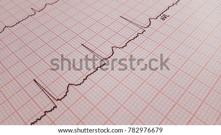 Close up of an electrocardiogram in paper form. ECG or EKG paper background for medical and healthcare concept.

 Royalty-Free Stock Photo #782976679