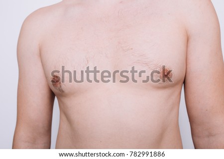 body parts: torso, legs and arms of young men. spots on the body: birthmark, condition. Wallpaper for your desktop and dermatological catalog. genetic diseases of the skin