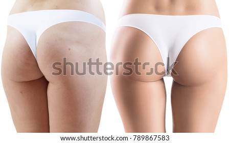 Female buttocks before and after spont and properly food.