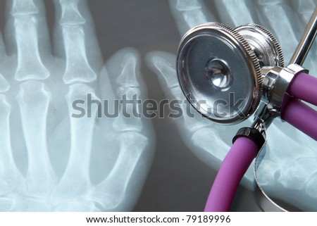 A medical stethoscope on an x-ray picture, closeup