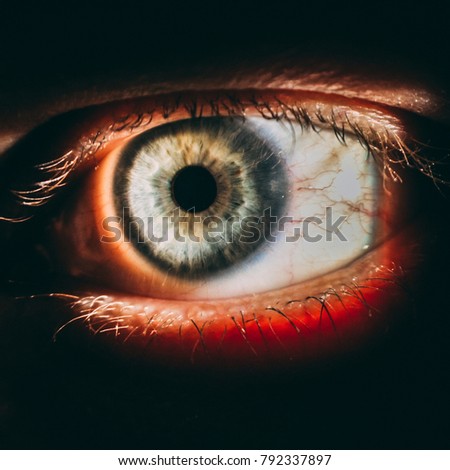 enlarged image of an eye iris made with a slit lamp
