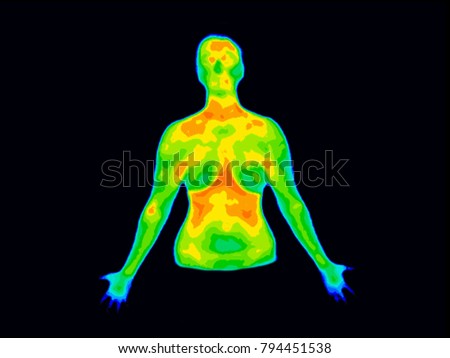 Photo of thermographic image of front of upper body of a woman showing different temperature in range of colors from blue showing cold to red showing hot which can indicate joint inflammation. Royalty-Free Stock Photo #794451538