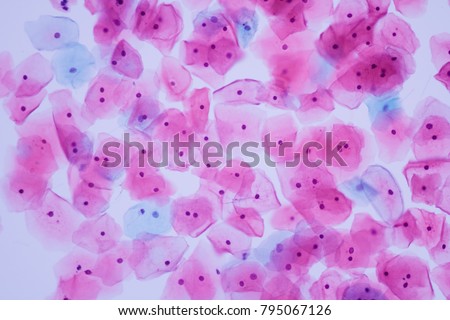 View in microscopic of normal human cervix cells.Squamous epithelial cells. Royalty-Free Stock Photo #795067126