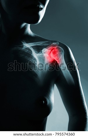 Human shoulder joint in x-ray, on gray background. The hand is highlighted by red colour.