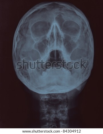 human head with open mouth xray picture (front view).