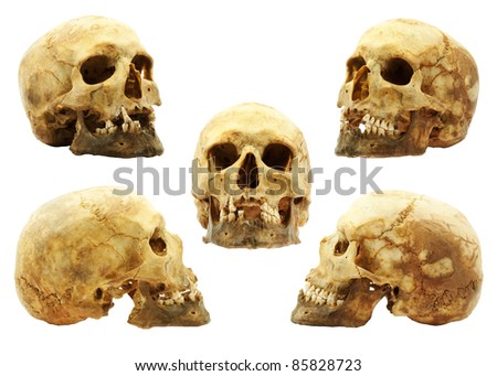 Real human skull isolated on white background, yellow lipid color absorbed into bone has been improved, multi picture