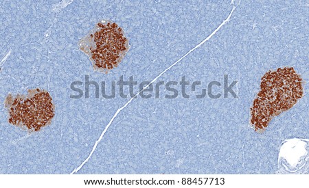 ISLETS-OF-LANGERHANS Stock Photos and Images - Avopix.com