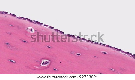 Bone forming cells osteoblasts lining the surface of mature cortical bone (pink substance in bottom half is bone). The bone has mature osteocytes in lacunae Royalty-Free Stock Photo #92733091