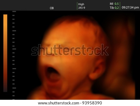 Image of a yawning newborn baby like 3D ultrasound of baby in mother's womb. Royalty-Free Stock Photo #93958390