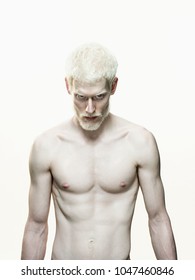 An Image Of Albino Man