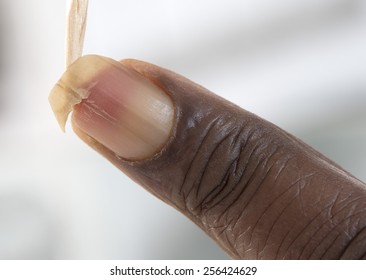 Image Of A Broken  Nail