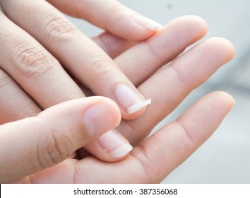 Image Of A Broken Nail Hand