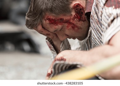 Image Of Male Car Crash Victim With Bloody Wound