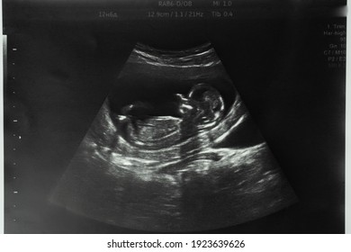 Image of mother's womb ultrasound during pregnancy. Ultrasound of a fetus at 12 weeks 6 days. Length 12,9 cm.