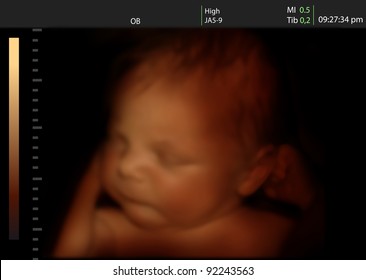 Image of newborn baby like 3D ultrasound  of baby in mother's womb.