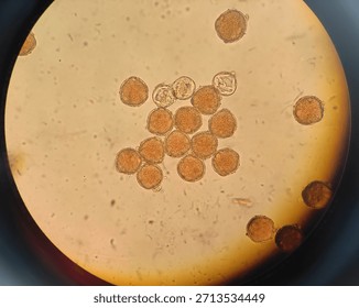 Image of Pollen Grain under Microscope