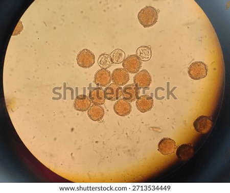 Image of Pollen Grain under Microscope