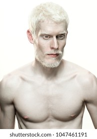 An Image Of Portrait Of An Albino Man