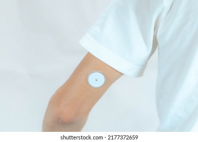 The Image Of A Sensor For Blood Glucose Glucose Monitoring Worn On Man's Upper Arm.
