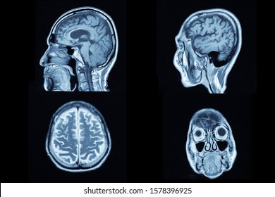 Image Show CT Brain And Human Body