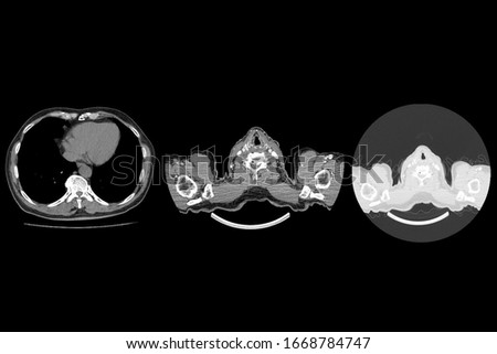Image show CT whole abdomen