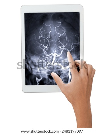 The image shows a hand pointing to a tablet with a cerebral angiography scan of the posterior cerebral artery isolated on white background. Clipping path.