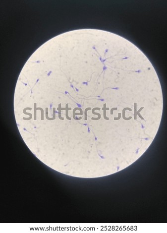 image of sperm under a microscope