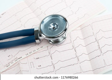 An Image Of Sthetoscope And Cardiogram Close-up