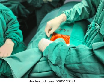 image of surgeon preparing the drape before commencement of surgery.