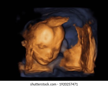Bild Ultrasound 3D, 4D des Babys im Mutterleib. 