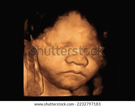 image Ultrasound 3D 4D of baby in mother's womb. 