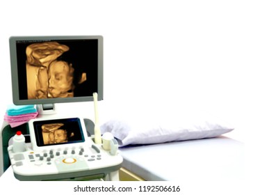 image Ultrasound 3D/4D of baby in mother's womb Show on moniter LCD  in the room hospital.Surface smooth/3D rotation image.Subject is blurry,too soft or out of focus when viewed at full resolution.