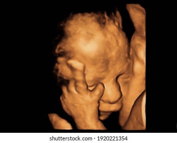Bild Ultrasound 3D4D des Babys im Mutterleib. 