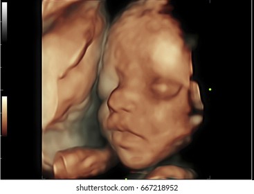 image Ultrasound  3D/4D  of baby in mother's womb.