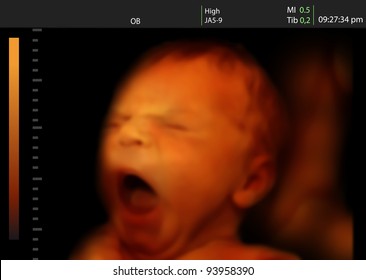 Image of a yawning newborn baby like 3D ultrasound of baby in mother's womb.