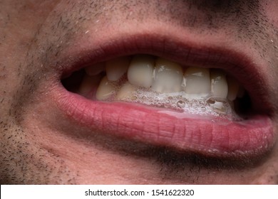 Image of young man with saliva, showing teeth