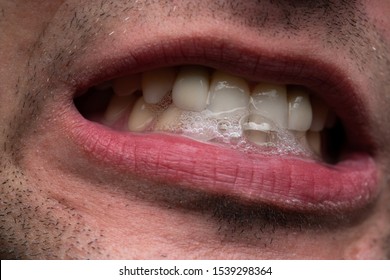 Image of young man, showing teeth, close up