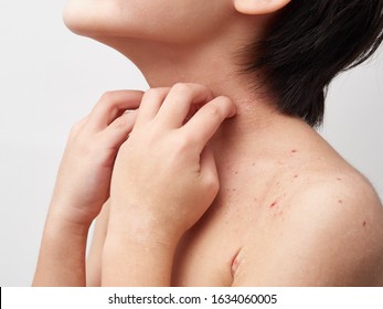 Images Of Atopic, Dry Skin And Dermatitis In Children