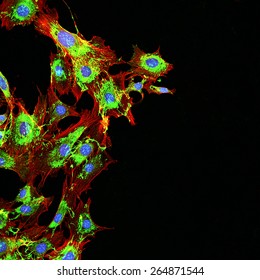 Imaging Of Metastatic Cancer Cells Spreading On The Surrounding Tissue.