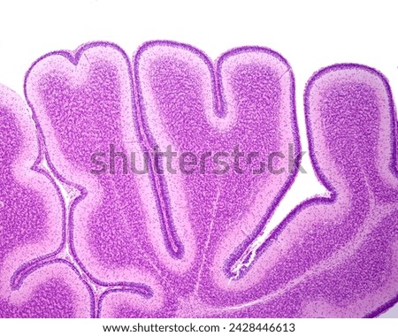 Immature cerebellar folium showing the external granular layer, a secondary germinal zone that produces granule cell progenitors that will later differentiate and then migrate into the granular layer [[stock_photo]] © 