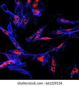 Immunofluorescence confocal imaging of melanoma cancer cells